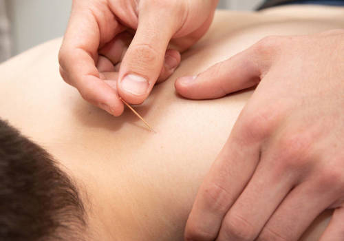 What can medical Acupuncture help to treat?